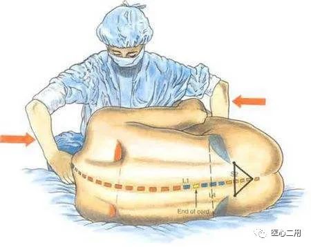 不(bù)要(yào)辯解,麻醉醫(yī)生(shēng)親自(zì)承認,麻醉就(jiù)是(shì)打一(yī)針……(圖4) 不(bù)要(yào)辯解,麻醉醫(yī)生(shēng)親自(zì)承認,麻醉就(jiù)是(shì)打一(yī)針……(圖4)